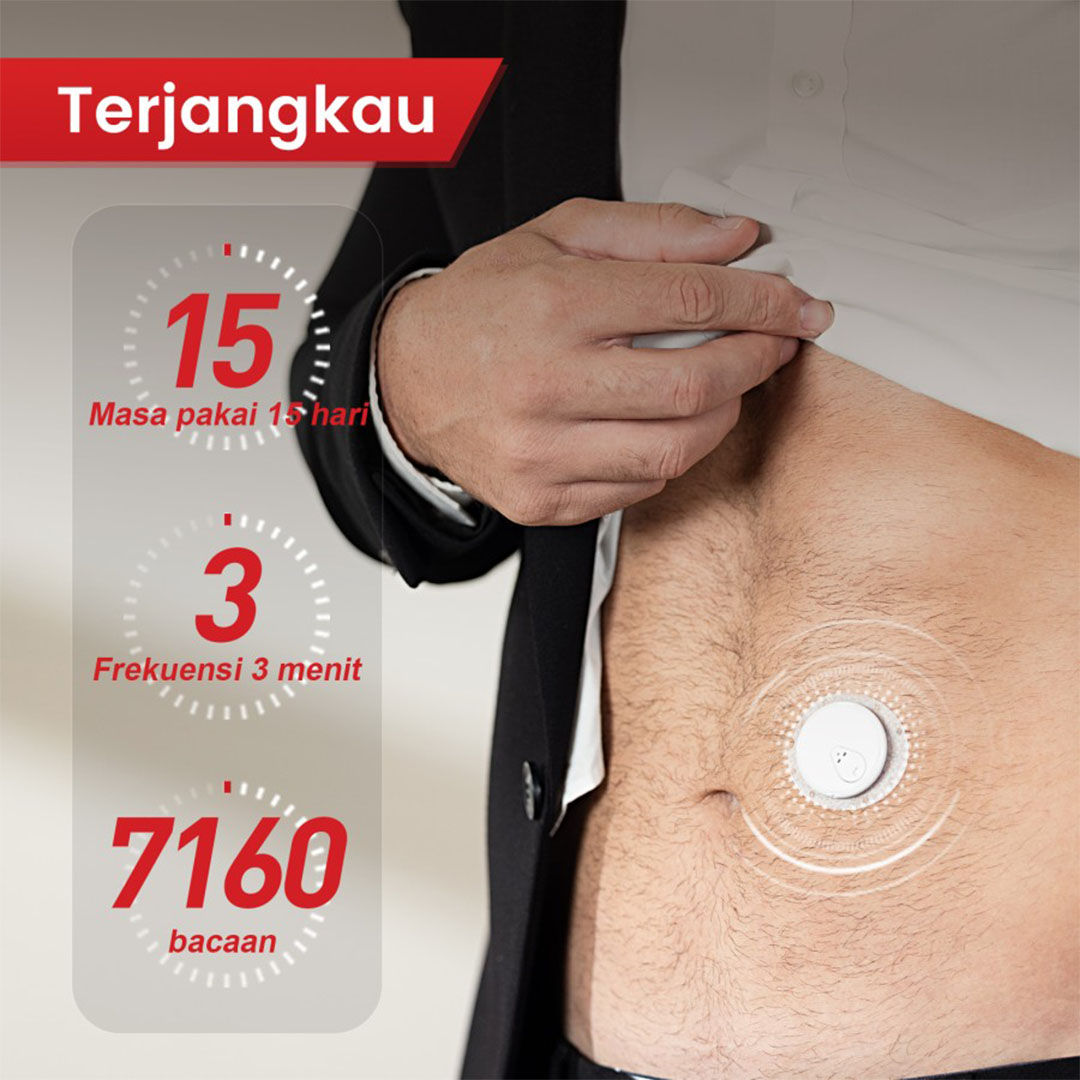 Sinocare iCan i3 Alat Cek Gula Darah 15 Hari Real Time