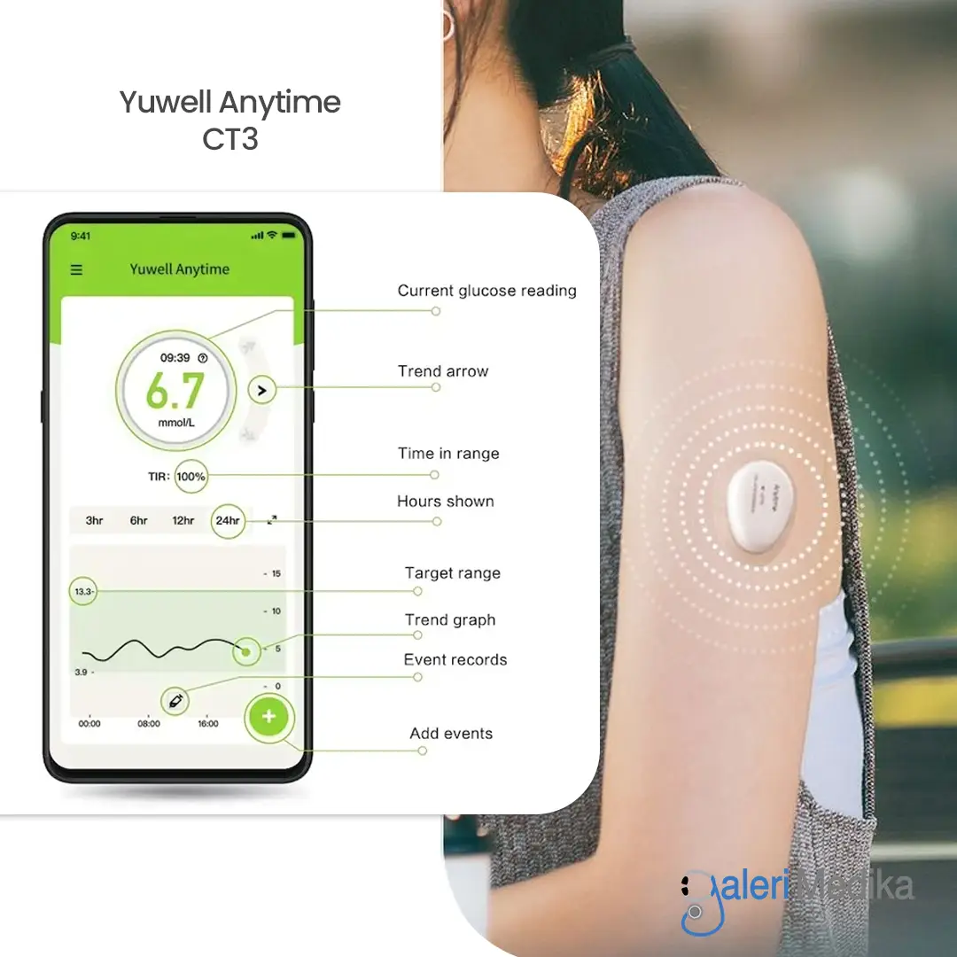 Yuwell Anytime CT3 Alat Cek Gula Darah Real Time Replaceable Sensor