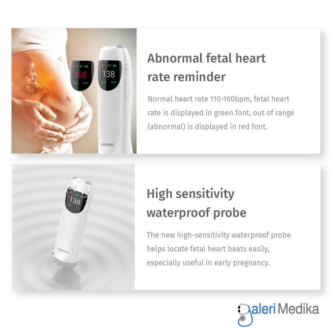 Portable Fetal Doppler Jumper SHA10 Wireless