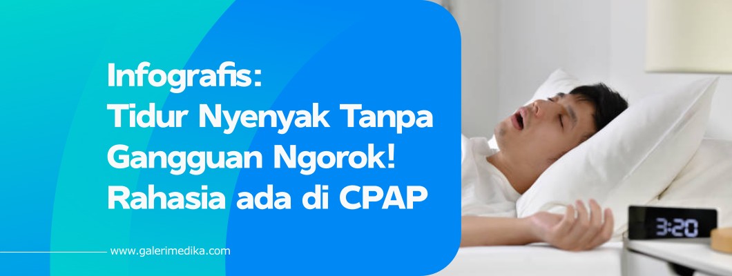 Tidur Nyenyak Tanpa Gangguan Ngorok! Rahasia ada di CPAP