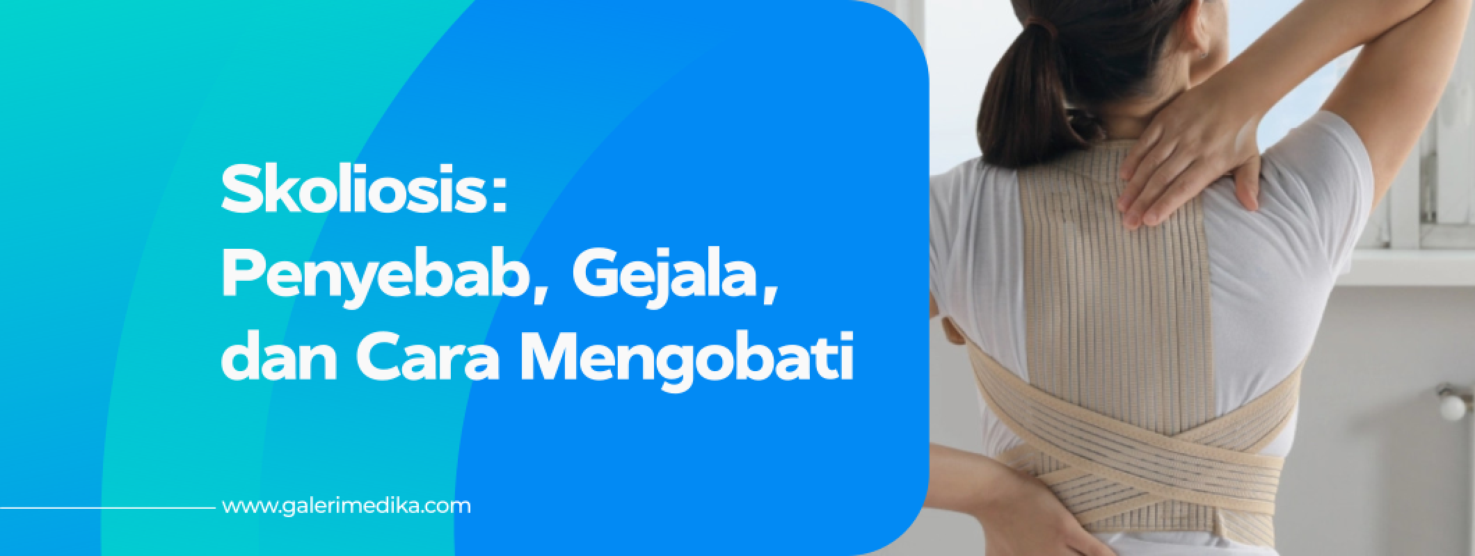 Skoliosis Penyebab Gejala Dan Cara Mengobati Galeri Medika