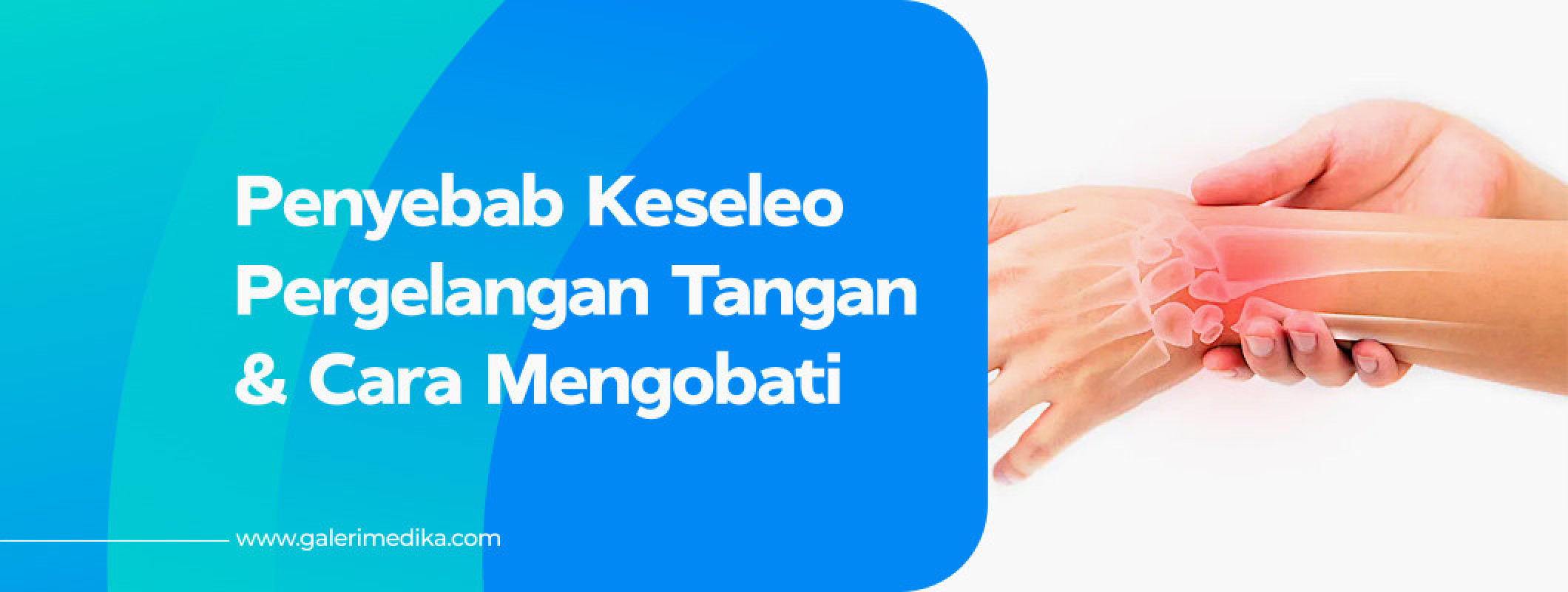 Penyebab Keseleo Pada Pergelangan Tangan Dan Cara Mengobati Galeri Medika 2066