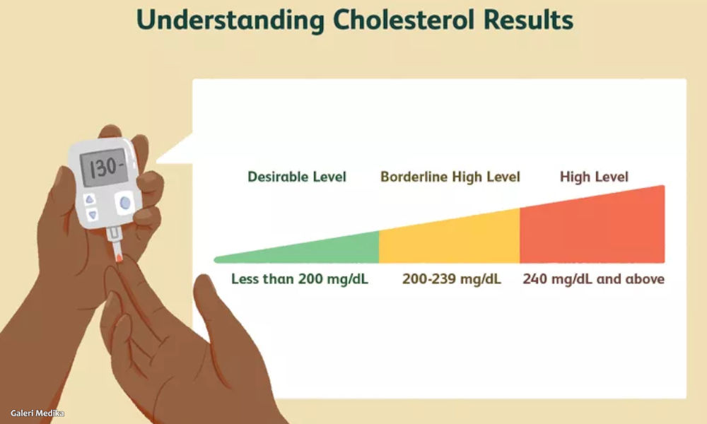 Apakah Jamur dapat Menurunkan Kadar Kolesterol di dalam Tubuh?